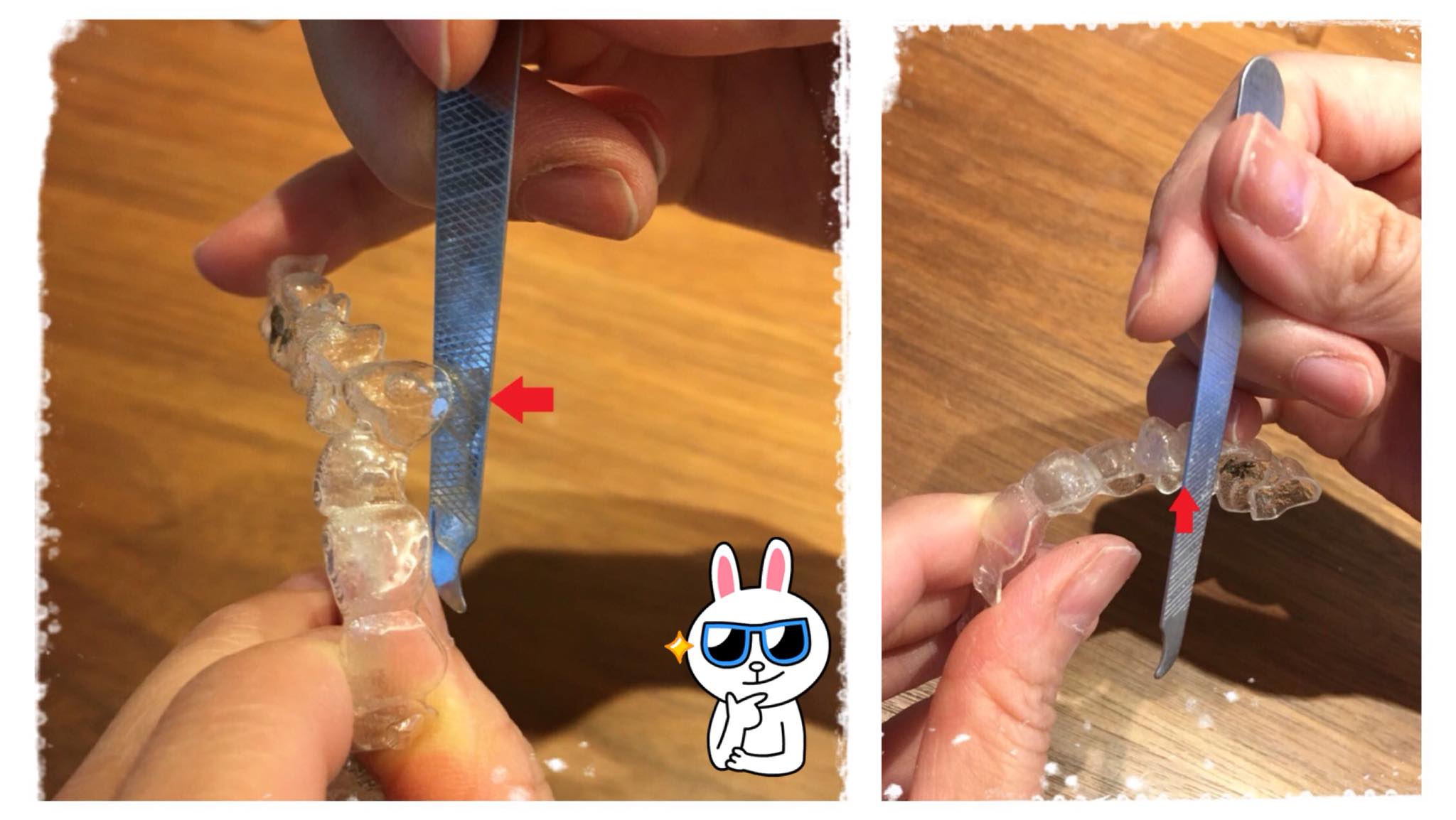 戴隱適美不舒服的解決方法ㄧ:用酒精消毒過的指甲刀稍微磨一下透明牙套上不是很平順的地方