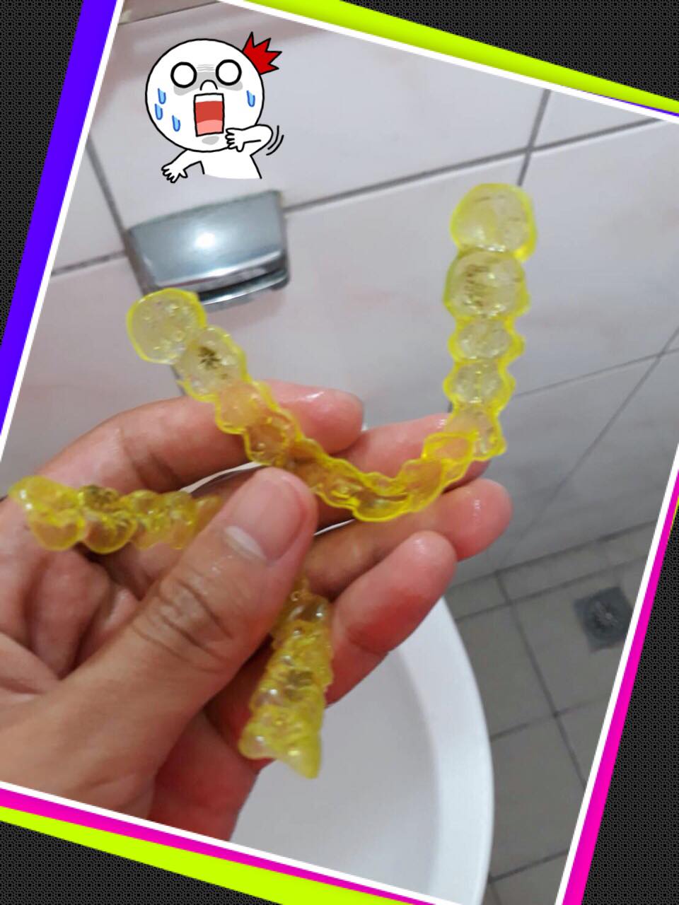 戴著隱適美牙套吃咖哩,透明牙套被染成黃色