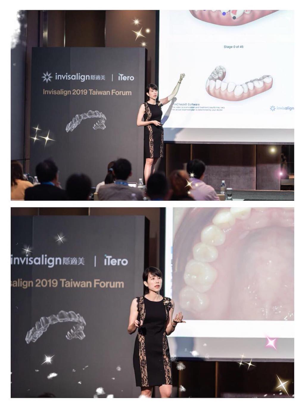 台中隱適美推薦矯正專家-楊念珊醫師講解矯正設計的邏輯與學習方式-2019隱適美台灣論壇
