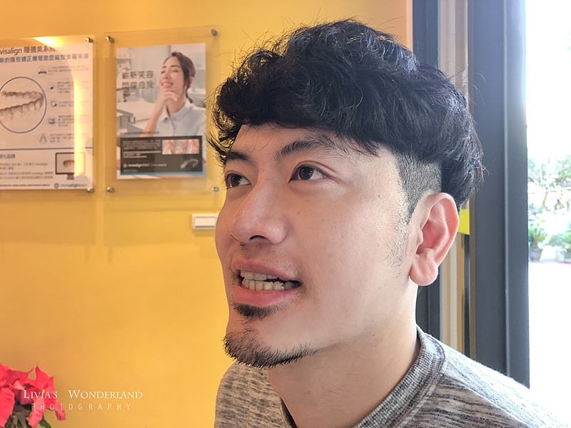 隱適美隱形牙套日記-invisalign-戴蒙矯正器-牙齒矯正心得比較-室內光線也看不出有戴牙套矯正牙齒