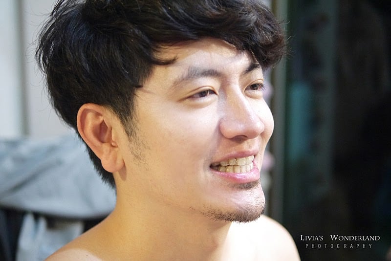 隱適美隱形牙套日記-invisalign-戴蒙矯正器-牙齒矯正心得比較-看不出有戴牙套矯正牙齒