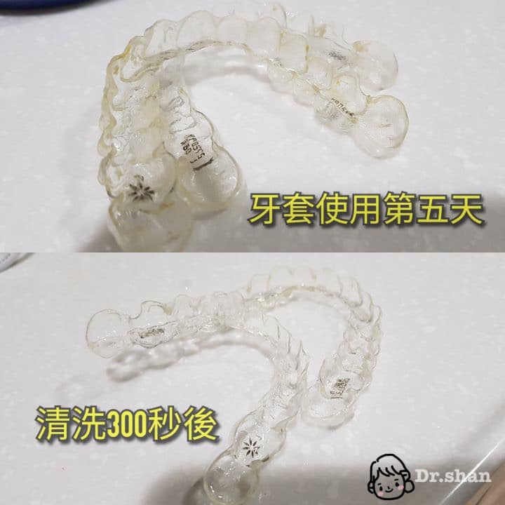 隱適美牙套清潔前後-超音波清洗器心得