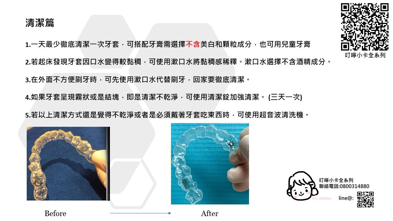 隱適美-隱形牙套-叮嚀小卡03.隱適美清潔-2022-台中隱適美推薦-Dr.珊