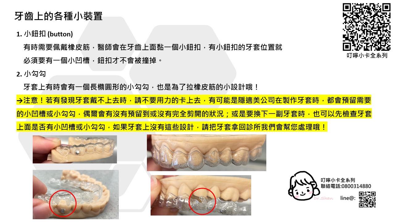 隱適美-隱形牙套-叮嚀小卡07-1.牙齒上的各種小裝置-2022-台中隱適美推薦-Dr.珊