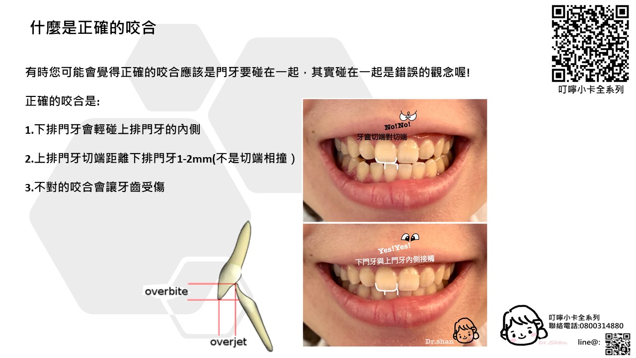 隱適美-隱形牙套-叮嚀小卡10-5.正確咬合-2022-台中隱適美推薦-Dr.珊