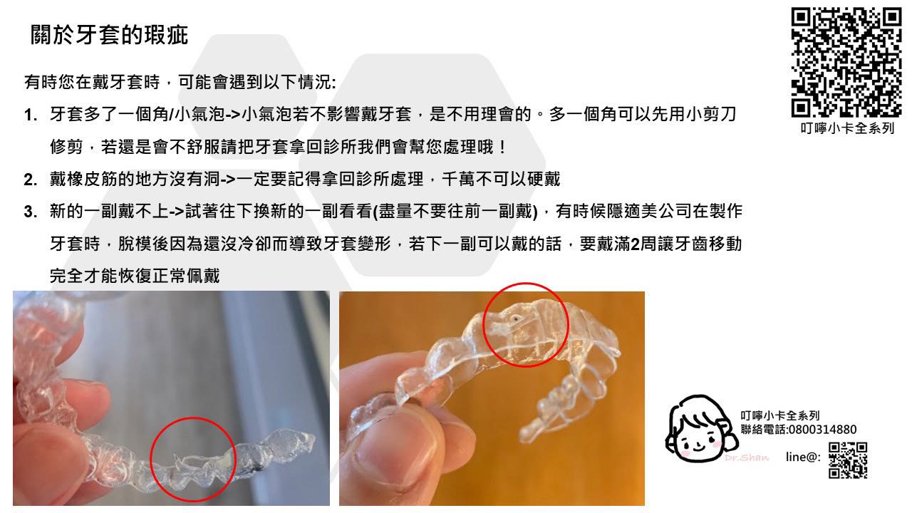 隱適美-隱形牙套-叮嚀小卡10-6.關於牙套的瑕疵-2022-台中隱適美推薦-Dr.珊