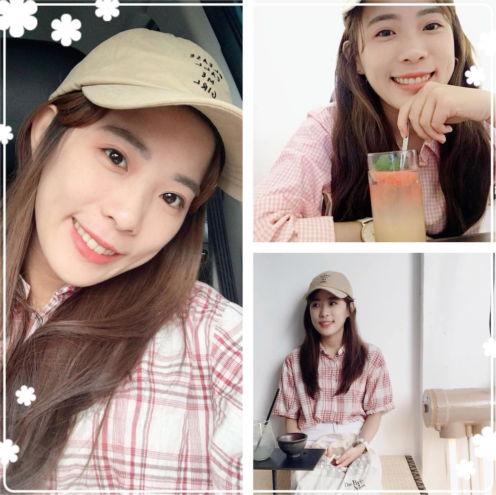 珊醫師隱適美推薦案例-我會將你當作我的好朋友