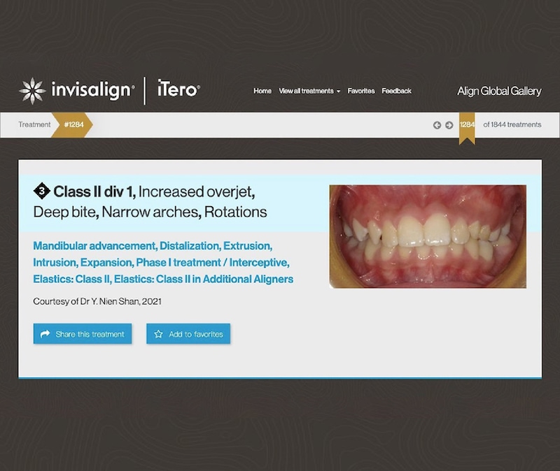 楊念珊醫師入選隱適美精選案例(Global Invisalign Gallery)