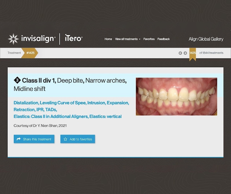楊念珊醫師入選隱適美精選案例(Global Invisalign Gallery)