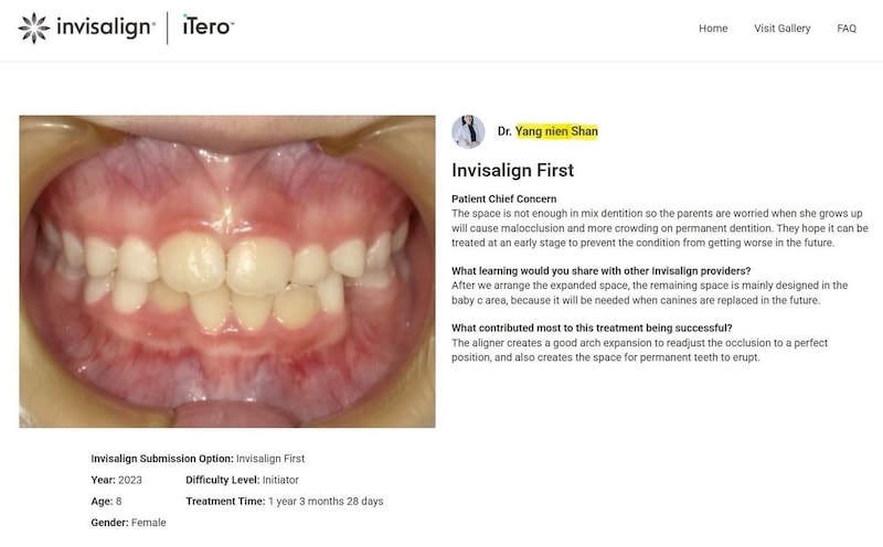 8歲女孩兒童隱適美First入選Align Global Gallery全球精選案例