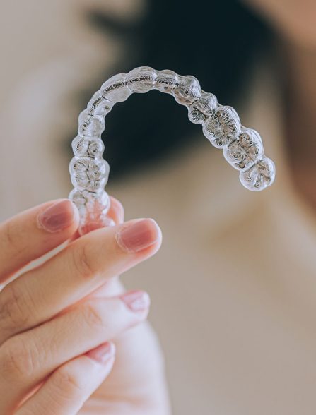 隱形矯正療程-隱適美(Invisalign)